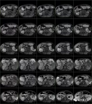 D:-CT-MR室资料新闻稿文件夹微信图片_20211127090830.jpg