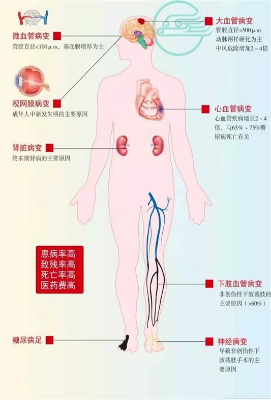 糖尿病.jpg