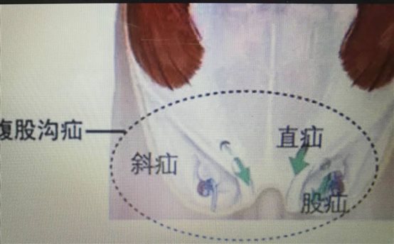 C:UsersADMINI~1AppDataLocalTempWeChat Files%9f12e91eaebcc96964bef21dce633.jpg