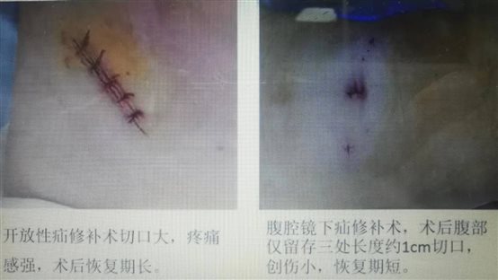 C:UsersADMINI~1AppDataLocalTempWeChat Files149a560dafe71488429fc7c38fb9bc.jpg