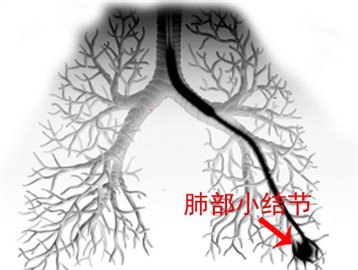 http://news.xinhuanet.com/health/2016-07/22/129169307_14691541927681n.jpg