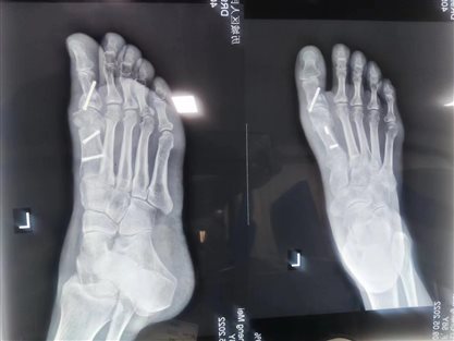 ee5a0815edb954c14c6ab24f4c665ee