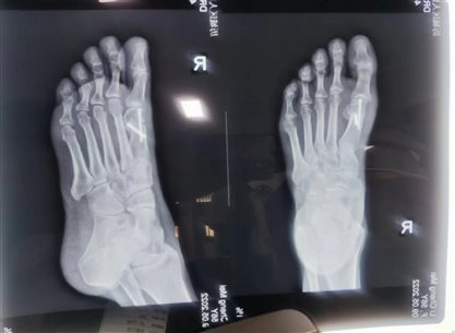 fd876dd33ee7707eb76a03fa64c9656