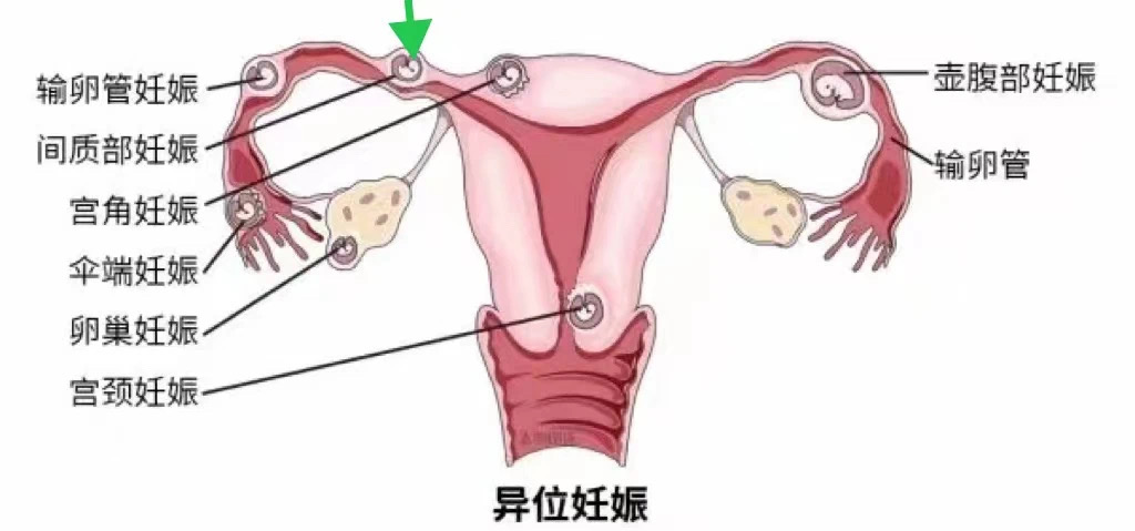 C:\Users\dell\AppData\Local\Temp\WeChat Files\db2b86d336c5afbf55f76616e922223.jpg