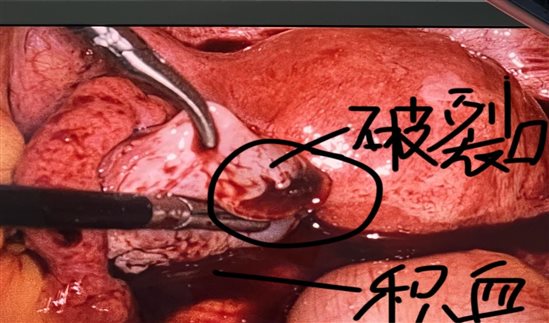 C:\Users\dell\AppData\Local\Temp\WeChat Files\2d0daa9414ec418a1337b4c9e364391.jpg