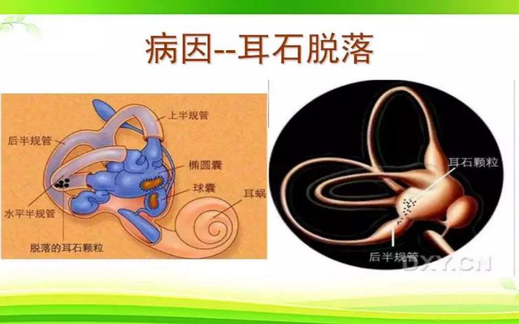 图片 2