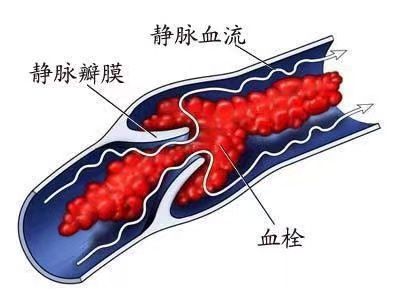 图片 3