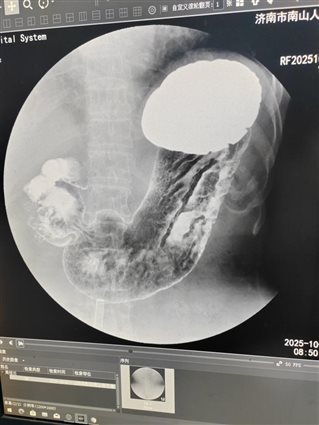 e5b2111a536aff6ce4ee7d9b4b2adb31