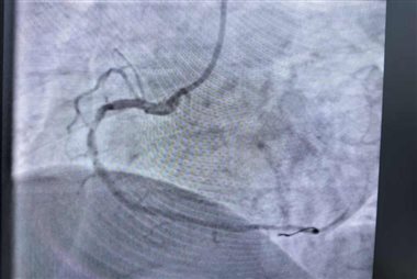 951cefa06e2a4e43788a34fa3222b499