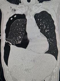 1f2352935e46bbf0f7c7d2804f177cb0