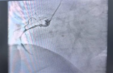 7661aff932d3a03d0f0466f48e27d999