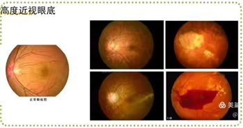 d9f6c6bf58a1bff2d228fd0cfbcaabb8