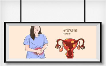 子宫肌瘤图片-子宫肌瘤高清图片素材大全-摄图网