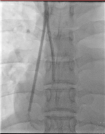 2026-01-21 07:45:04.323000