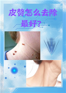 f7d190c45fe1a4ebb5ae8d92a60db6cc