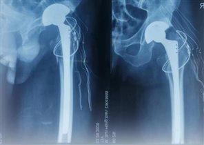 fec8605319b126cb881875c41202835