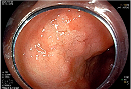 2026-03-27 16:10:41.955000