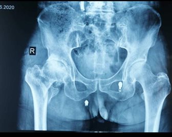 图示, 示意图

中度可信度描述已自动生成:ver1